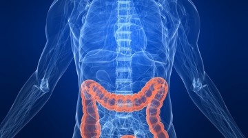 Lo que debe saber sobre el cáncer colorrectal