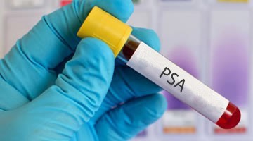 ¿Qué es la Prueba del PSA?